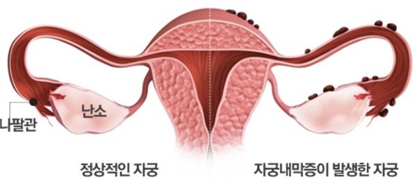 (사진출처=서울대병원)